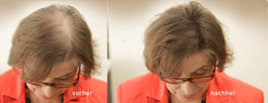 Haarverdichtung: Vorher-Nachher mit Cover Hair