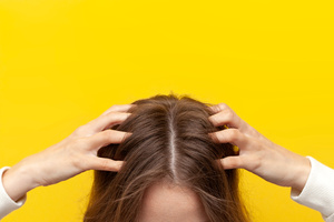 Frau hält Hände auf den Kopf Wie entsteht Haarausfall